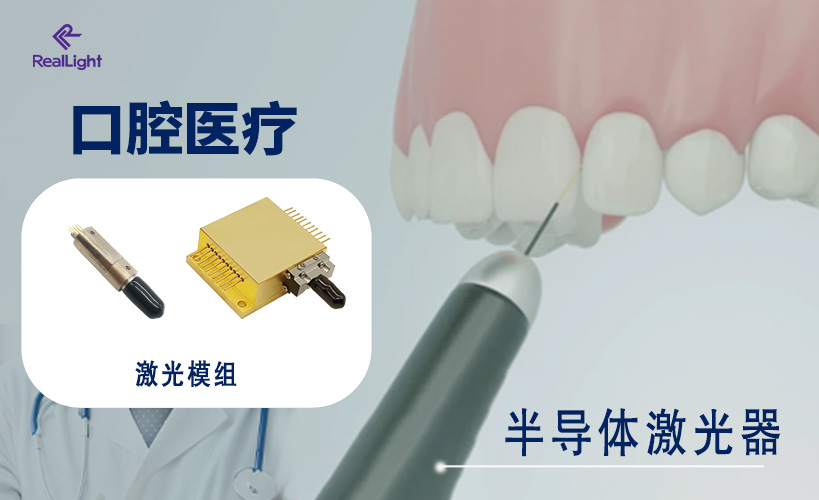 半导体激光器在口腔医疗中的应用