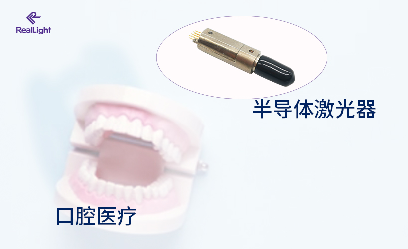 半导体激光器在口腔医疗领域的应用