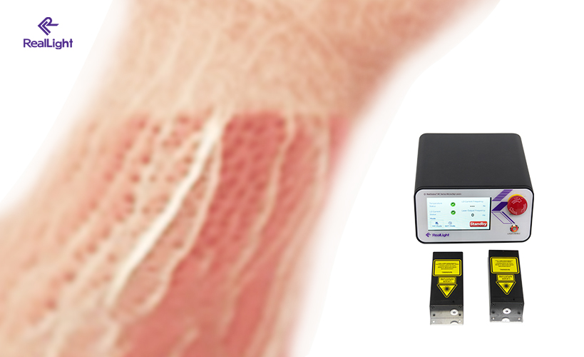 微片激光器：光声成像领域的新星